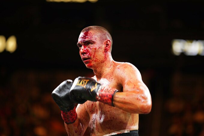 Кровавый махач! Фундора победил Тима Цзю и завоевал пояса WBC и WBO
