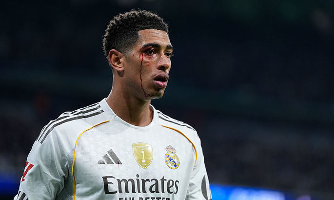 Ла Лига. Реал в сверхэмоциональном матче с двумя удалениями уступает Сельте Ла Лига. Реал в сверхэмоциональном матче с двумя удалениями уступает Сельте