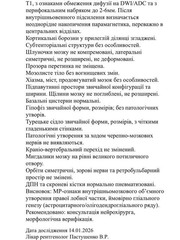 2 эпилептических припадка: у дважды чемпиона Украины проблемы со здоровьем