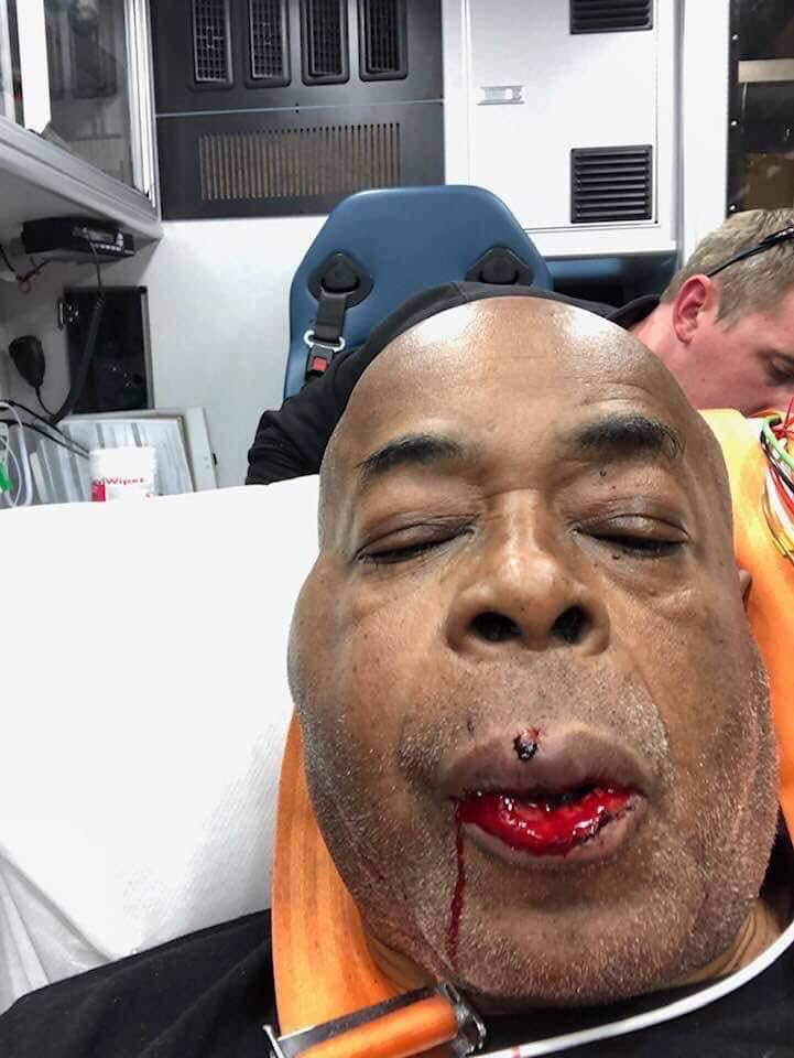 Екс-тренера Кличка і Усика жорстоко побили Екс-тренера Кличка і Усика жорстоко побили