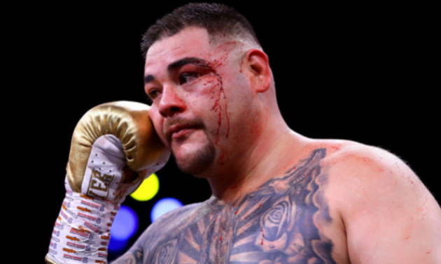 Руїс: Я набрав занадто багато ваги Руїс: Я набрав занадто багато ваги