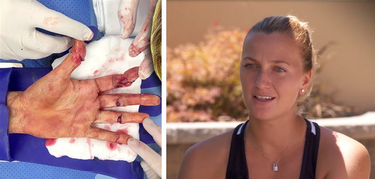 Злочинця, що напав на Квітову засудили на вісім років Злочинця, що напав на Квітову засудили на вісім років