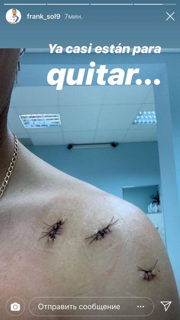 Легіонер "Динамо" показав шви на тілі (ФОТО)