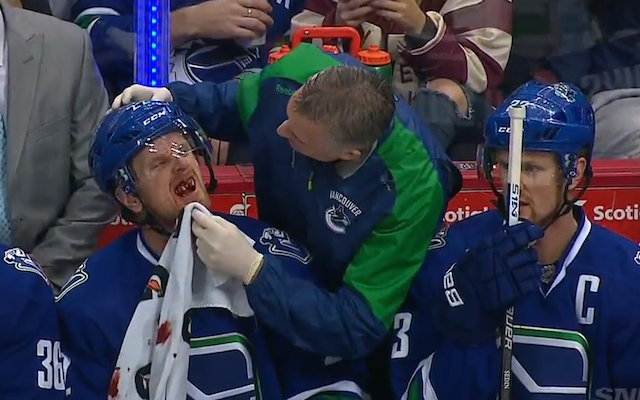 Выбитые зубы как визитная карточка хоккея